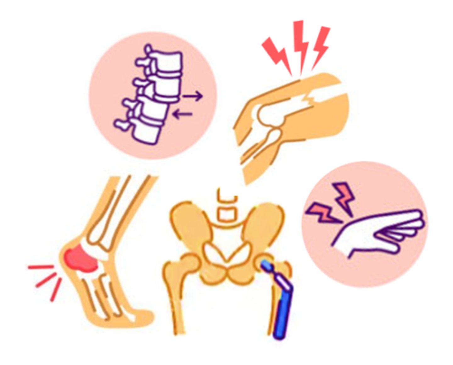 <p>injuries or disorders of the muscles, nerves, tendons, joints, cartilage, &amp; spinal discs</p>