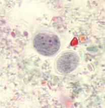 <p>Professor: Dr. Glena Fe A. Yapchulay-Alcabasa</p>