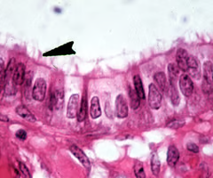 <p>single layer of tall column shaped cells</p><ul><li><p><strong>absorption</strong>, secretion of mucus, enzymes and other substances</p></li><li><p><u>nonciliated</u> types lines most of the<strong> digestive tract </strong>(stomach to anal canal), gallbladder and excretory ducts of some glands</p></li><li><p><u>ciliated</u> variety lines small bronchi, <strong>uterine tubes</strong>, and some regions of the uterus</p></li></ul><p></p>