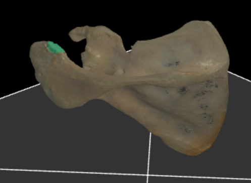 <p>articulatievlak op acromion voor clavicula</p>