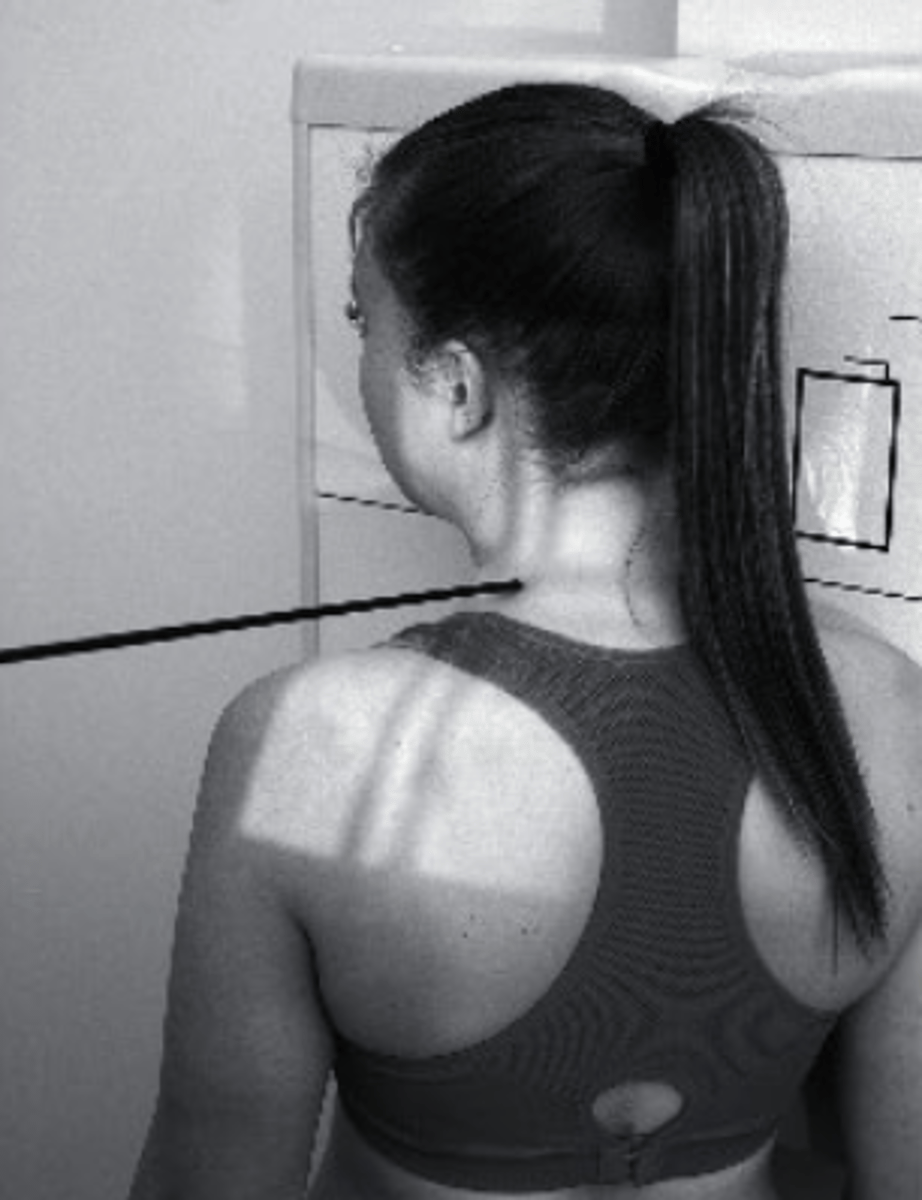 <p>What view is being captured here?</p><p>a. lateral</p><p>b. Odontoid</p><p>c. oblique</p><p>d. AP</p>