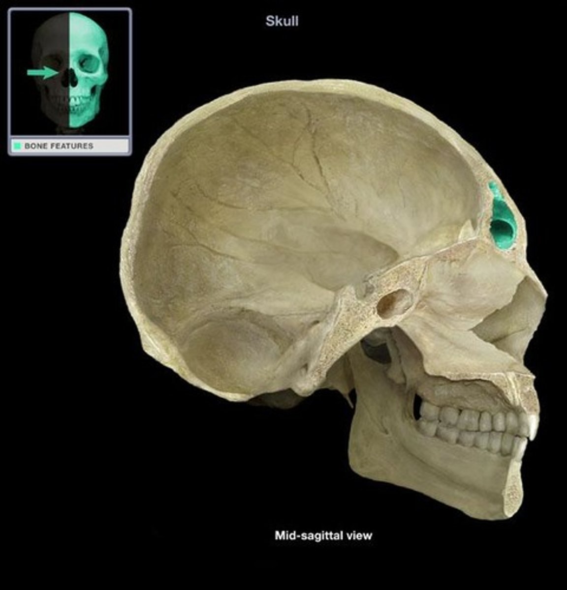 <p>SINUS LOCATED IN THE FOREHEAD OF THE SKULL</p>