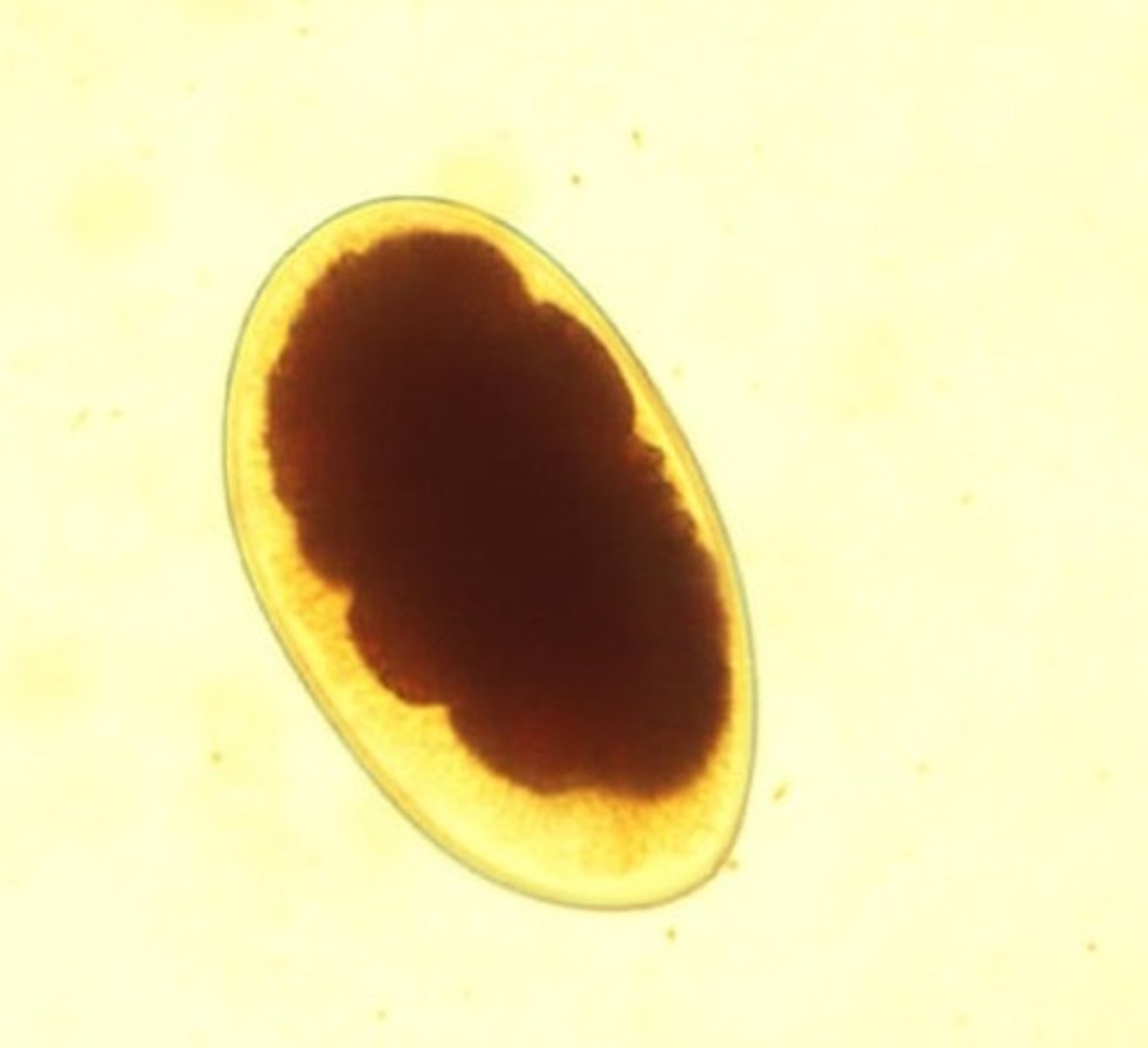 <p>Identify the parasite</p>