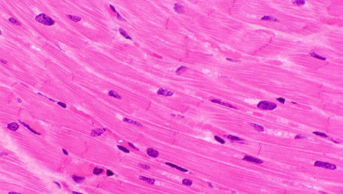 <p>Striated Involuntary muscle</p><p></p><p>Forms most of the volume of the heart and makes up most of the walls of the cardiac chambers.</p><p></p><p>Contracts rhythmically, without external stimulation</p><ul><li><p>Groups of cardiac muscle cells adopt the contraction rate of the most rapid cell in the group.</p></li></ul><p></p>