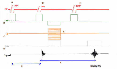 <p><span><strong>Letter B in Image 75 represents:</strong></span></p>