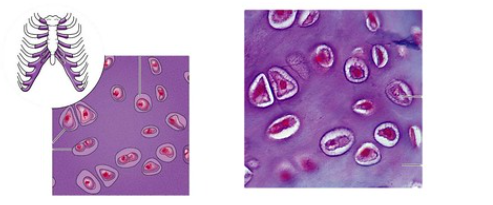 Hyaline cartilage

