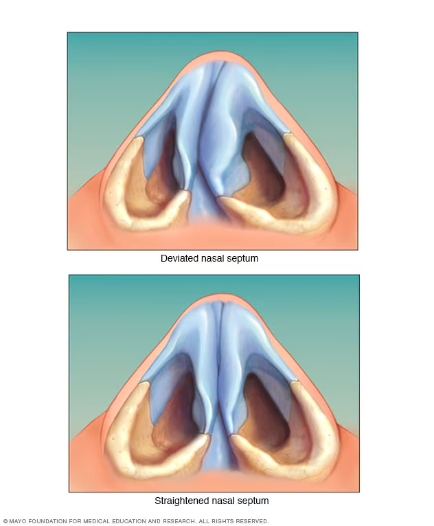 <p>Nasal septum.</p>