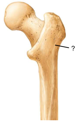 <p>Nom et caractéristiques de ce relief ?</p>
