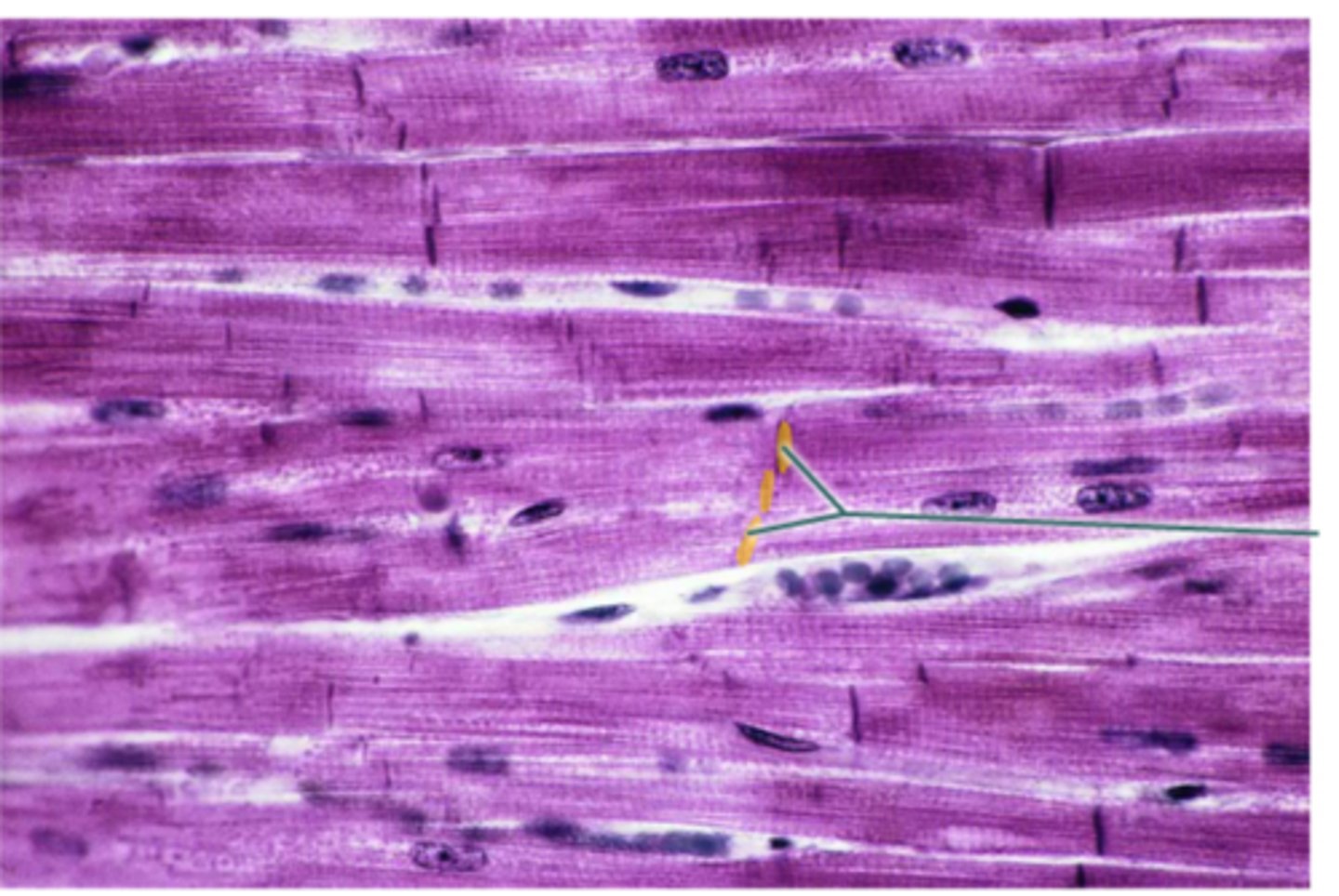 <p>intercalated discs</p>