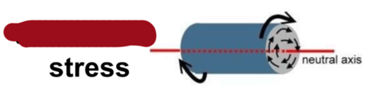 <p>type of stress?</p>