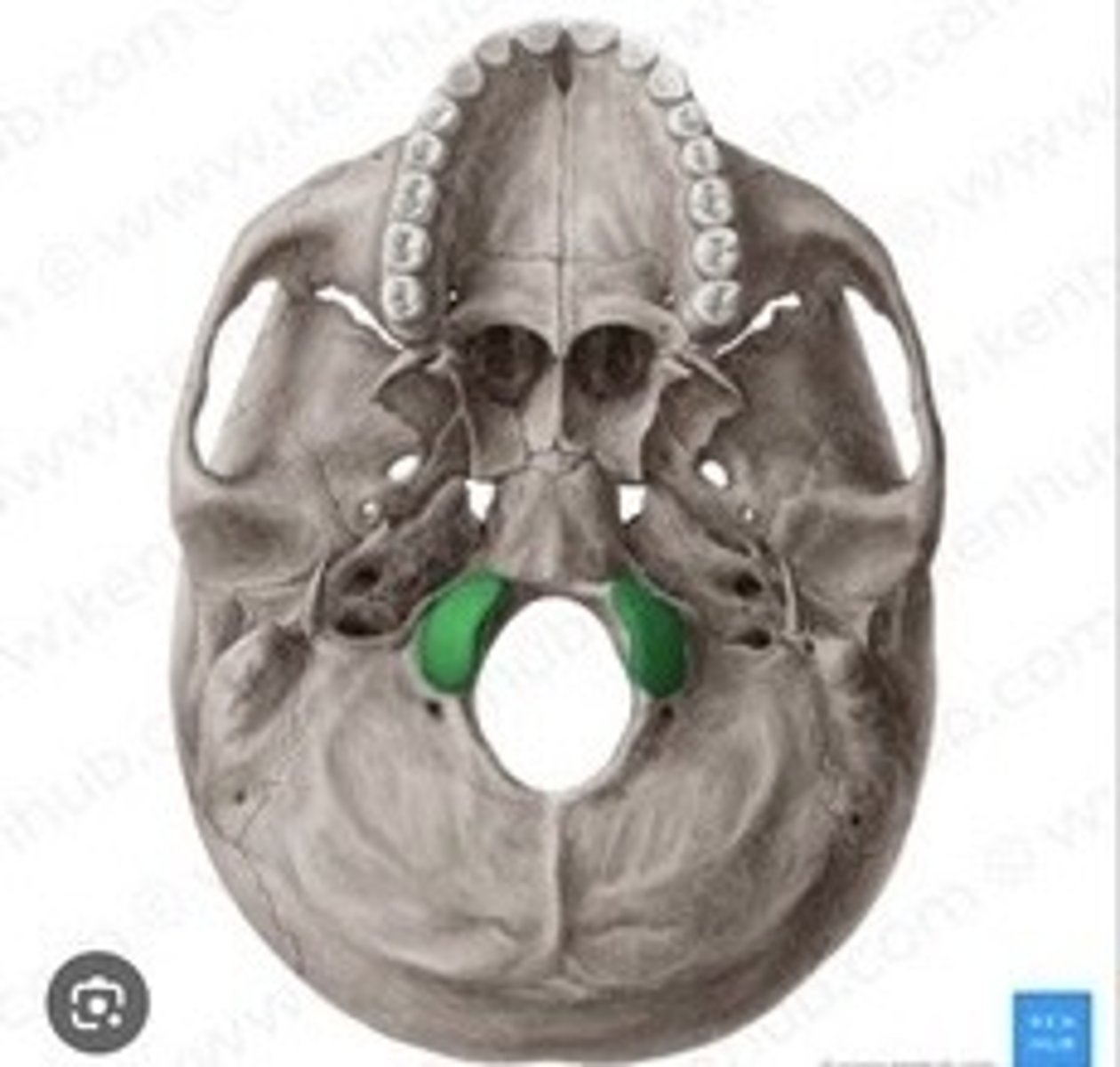 <p>Articulates with the first cervical vertebra.</p>