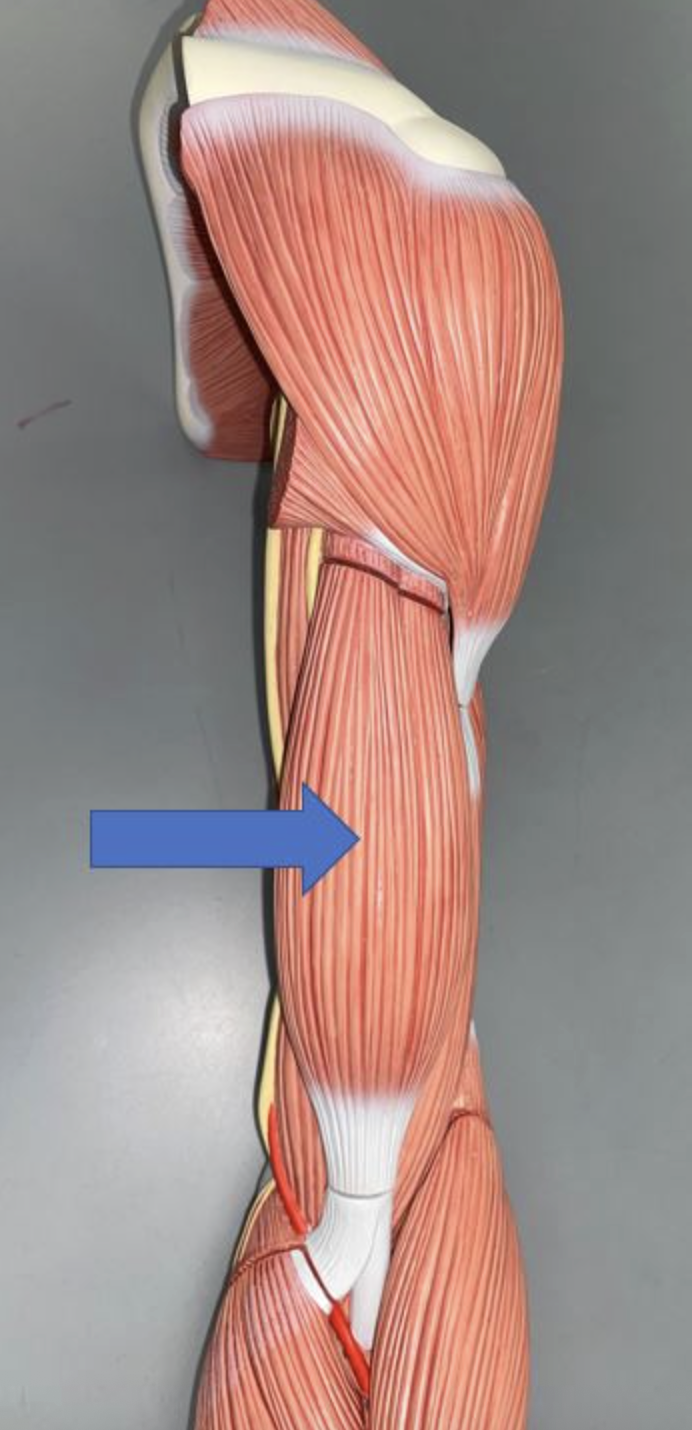 <p>muscle & function</p>