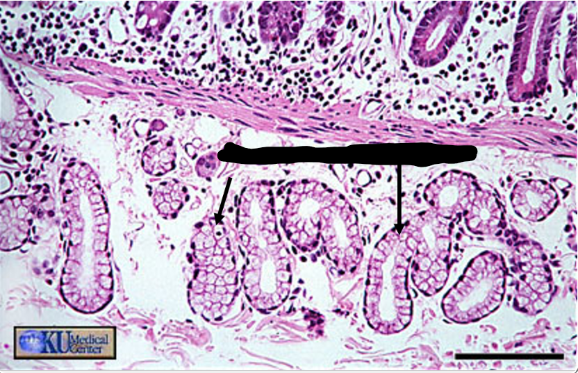 <p>the arrows point to</p>