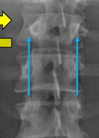 <p>Q what position is the spine in here?</p>