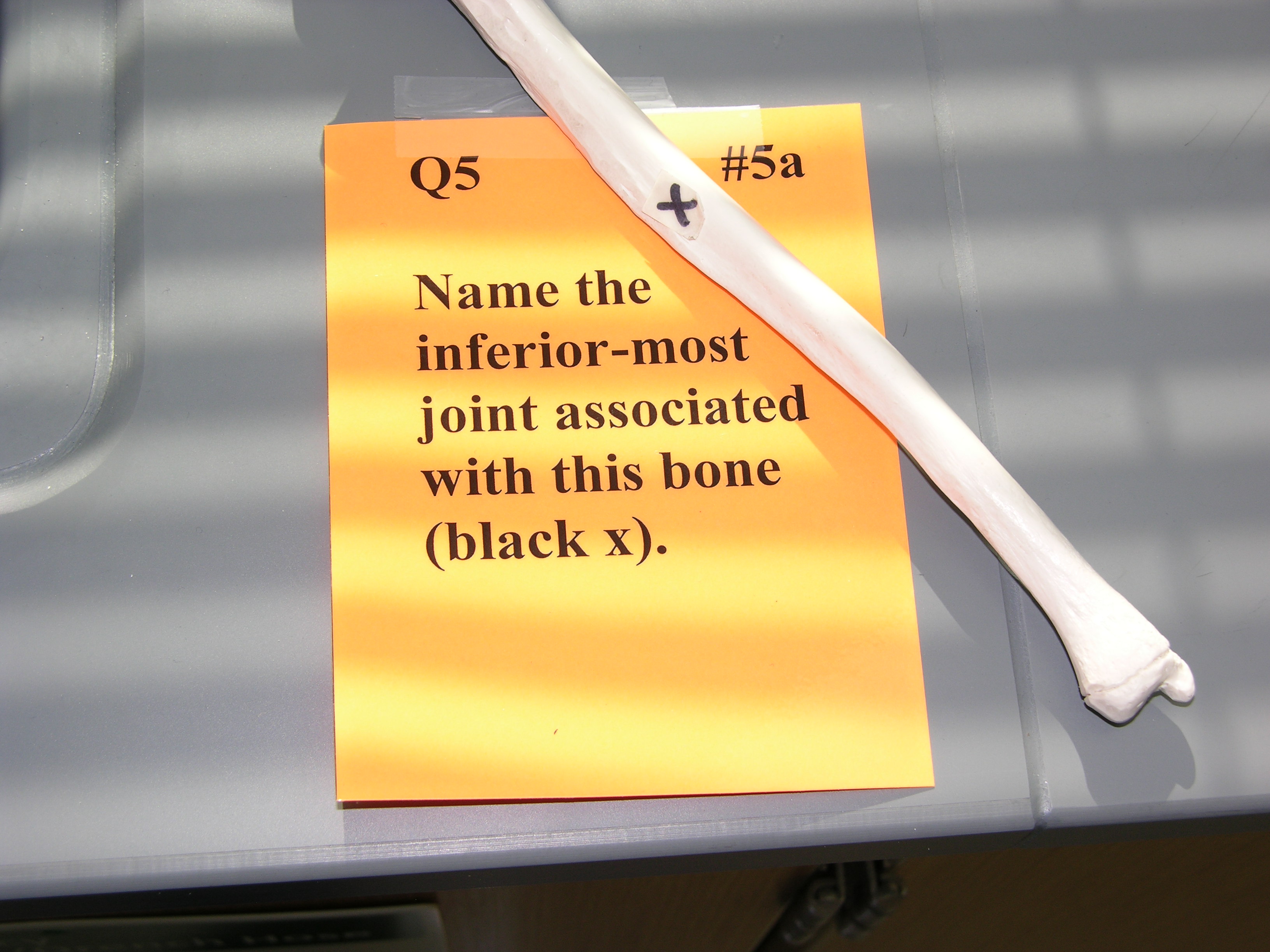 <p><span style="font-family: Lato Extended, Lato, Helvetica Neue, Helvetica, Arial, sans-serif; color: rgb(45, 59, 69)">Name the inferior-most associated with this bone.</span></p>