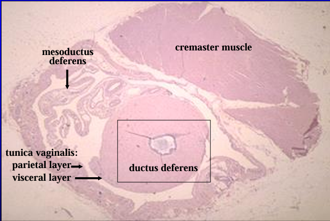 <p>Cross-section of the canine spermatic cord. H-E stain. </p><p>The section includes the ductus deferens, mesoductus deferens and blood vessels, parietal and visceral layers of the tunica vaginalis, and cremaster muscle (striated skeletal muscle).</p>
