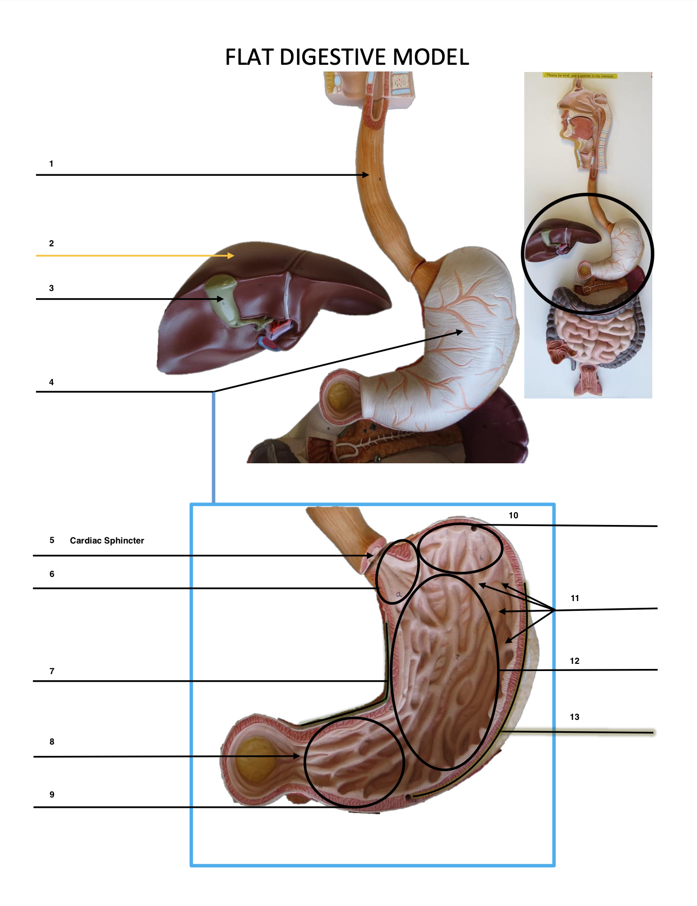 <p>Cardiac Sphincter</p>