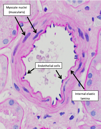 <p>apical surface is smooth</p><p>width greater than height</p><p>flattened nucleus</p><p>rest on the basement membrane</p><p>ex: cornea and blood vessels (endothelium), air sacs of lungs</p>