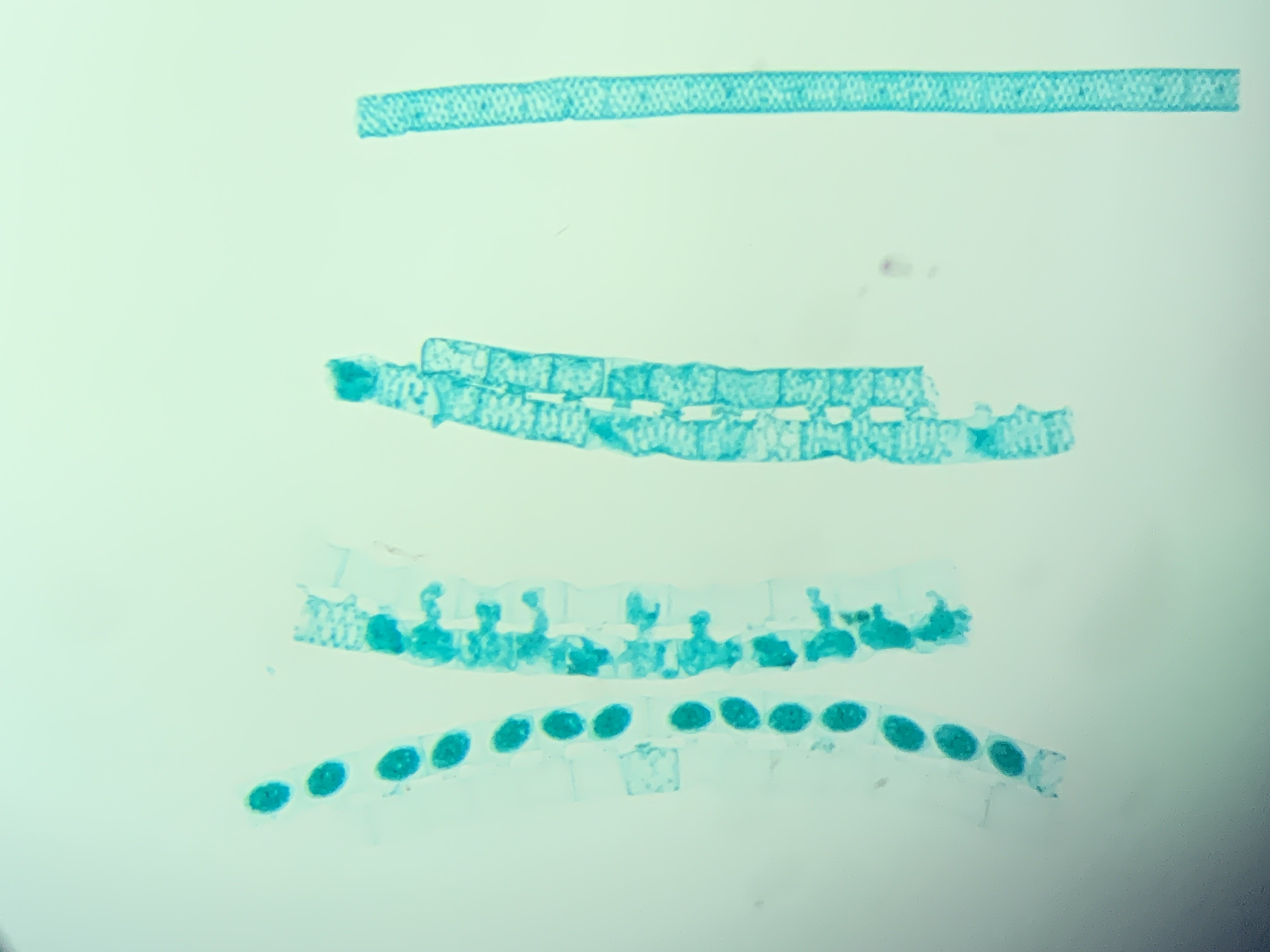 <p>Spirogyra - <span>Chlorophyta </span></p>