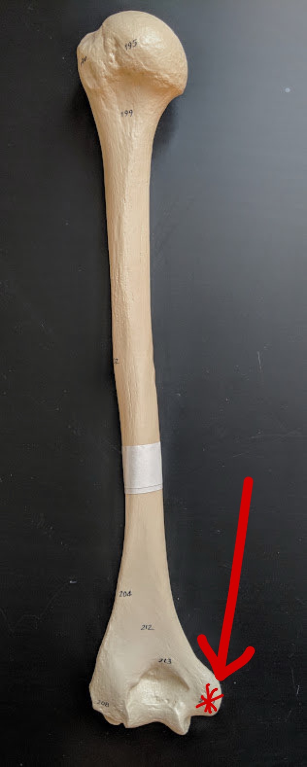 <p>Name this structure</p>