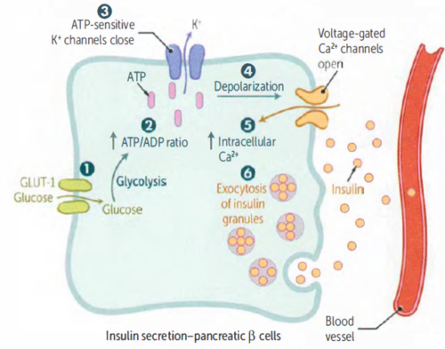 <p>1. glucose lands on GLUT2= enters beta cell</p><p>2. metabolism</p><p>3. increased ATP/ADP ratio [AND GPCR activation-> Ip3-> calcium]</p><p>4. ATP causes K channel to close (K cannot leave)</p><p>5. membrane depolarization (more +)</p><p>6. Voltage dependent calcium channel opens (VDCC)</p><p>7. Ca2+ rushes in</p><p>8. increased Ca promotes insulin granule exocytosis</p>