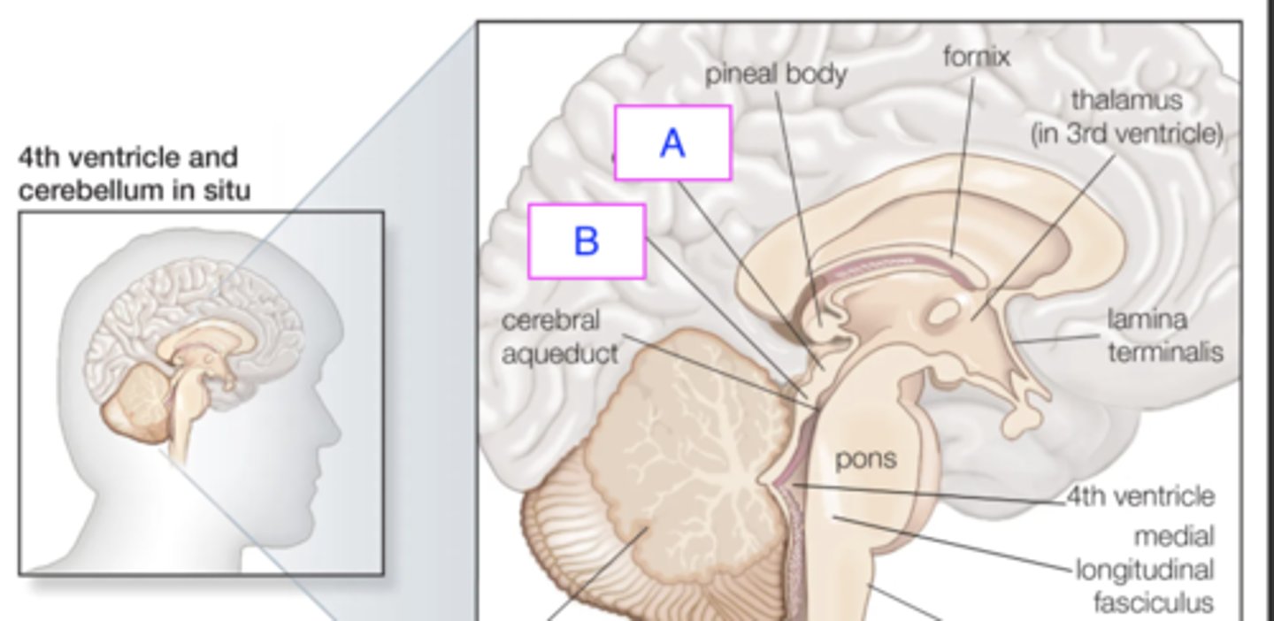 <p>ID structure (B)</p>