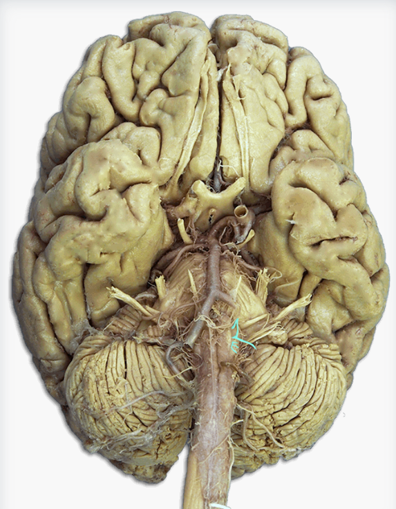 <p>Label this cranial nerve</p>