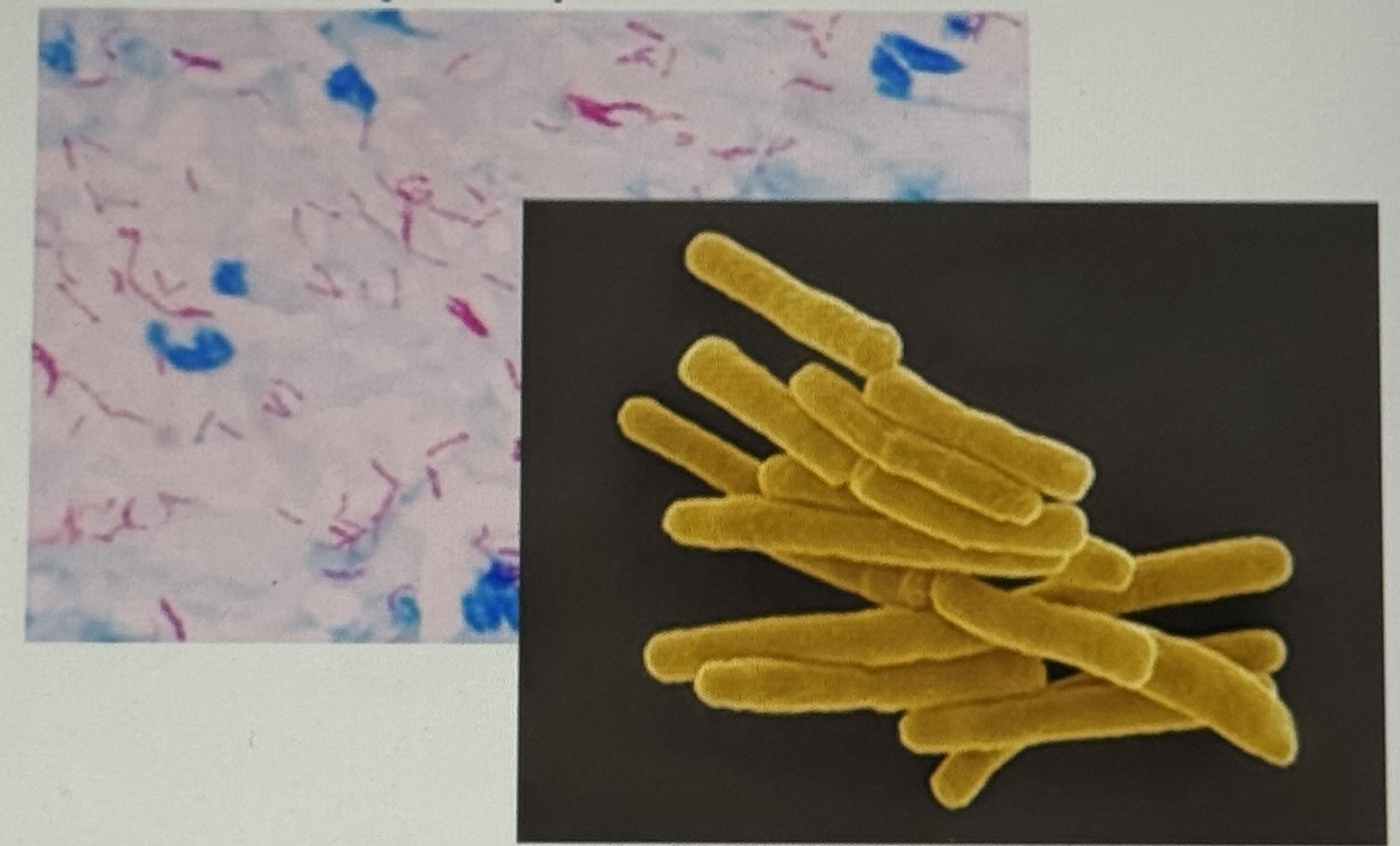 <p>Mykobakterien (z.B. Mycobacterium tuberculosis und Mycobacterium leprae) Steckbrief</p>