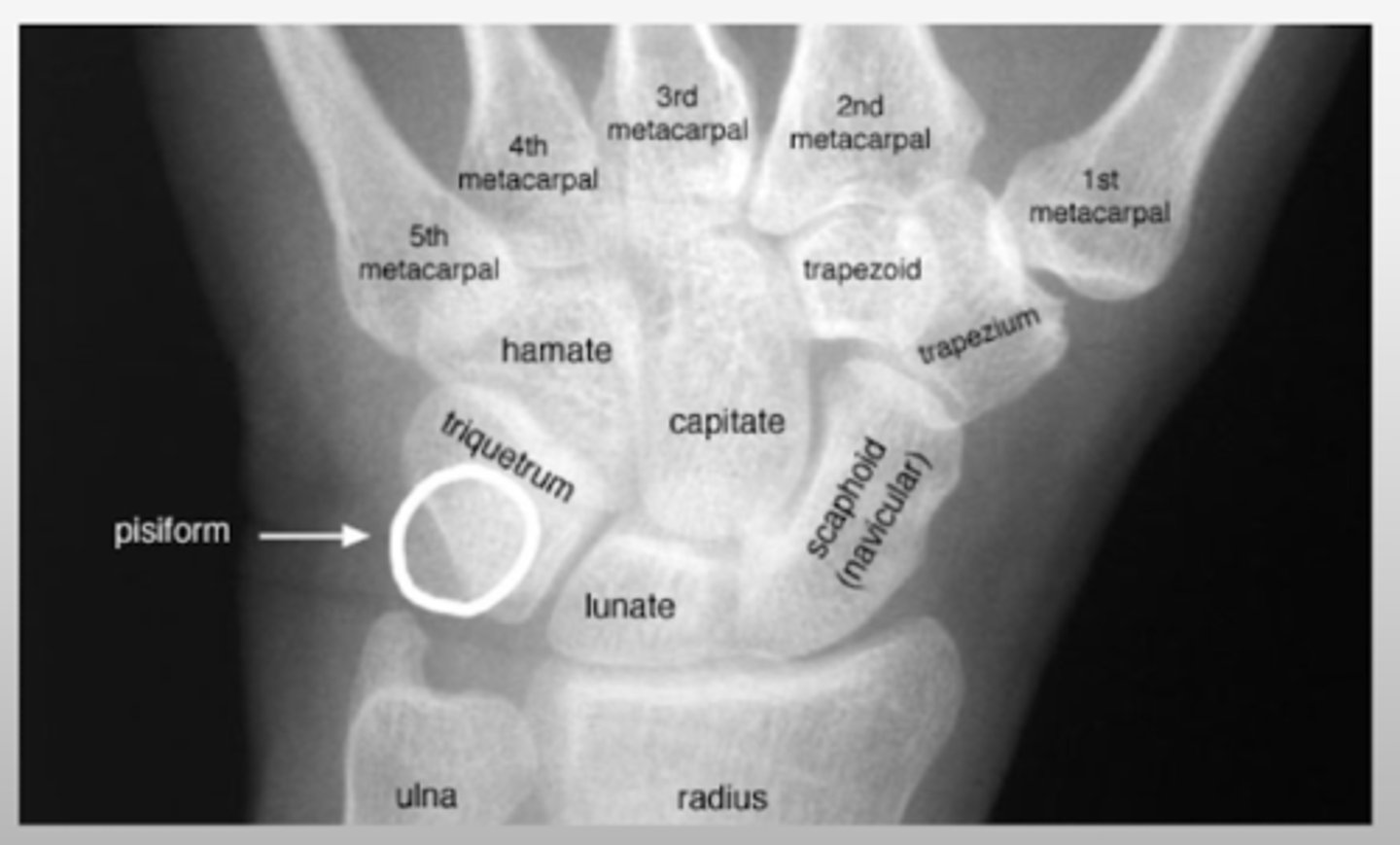 <p>So Long To Pinky Here Comes The Thumb</p><p>Scaphoid</p><p>Lunate</p><p>Triquetral</p><p>Pisiform</p><p>Hamate</p><p>Capitate</p><p>Trapezoid</p><p>Trapezium</p>