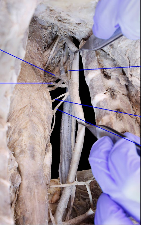 <p>Name bottom left artery</p>