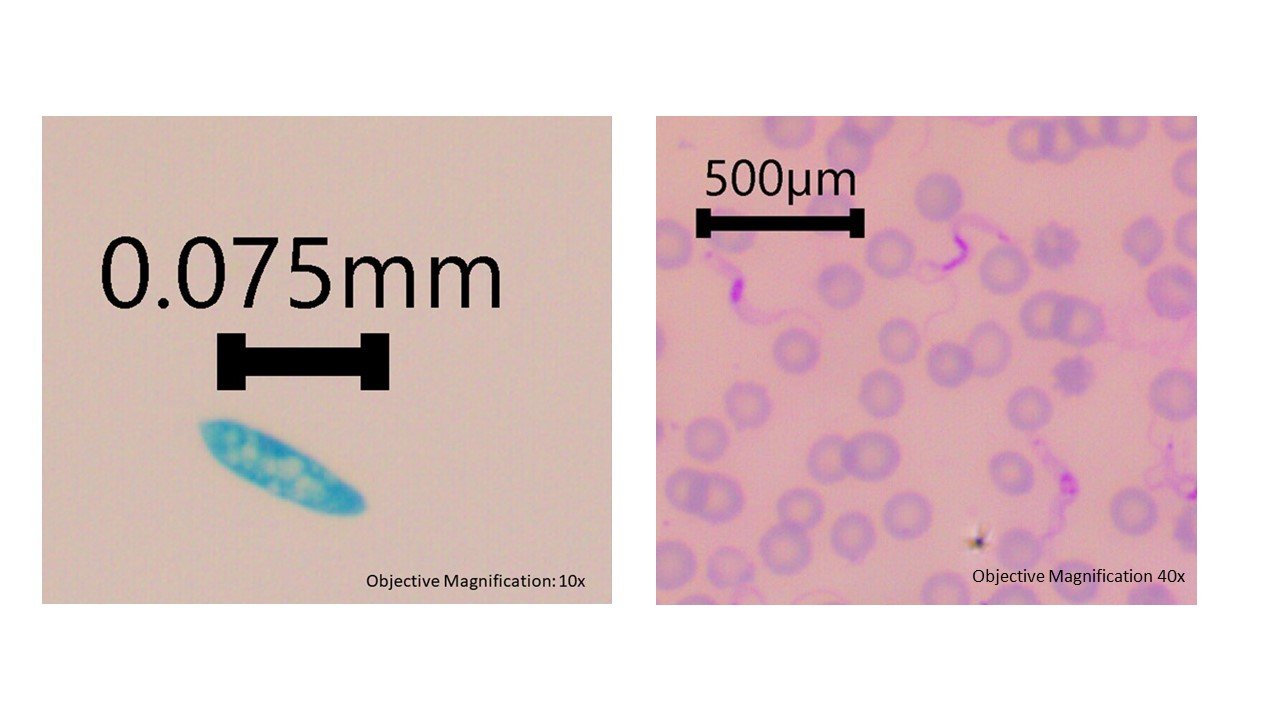 <p><span>which supergroup do Kinetoplastida, Diplomonads, Parabasilids, Euglenazoans and Euglenids belong to</span></p>