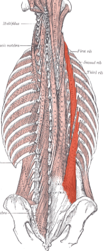 <p>Muscle of vertebral column</p>