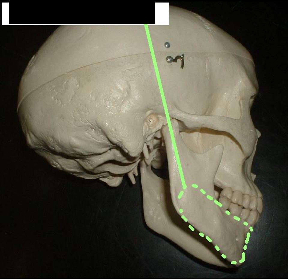 <p>the bottom of the mandible from a side view </p>