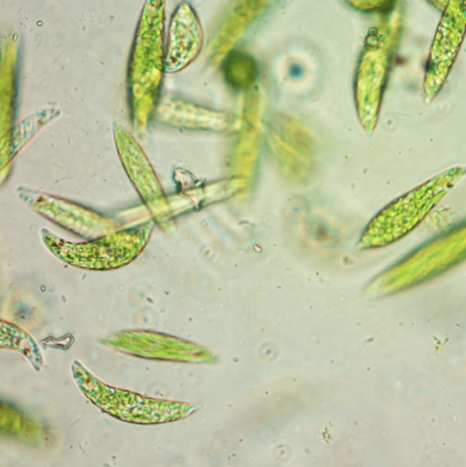 * Unicellular, Phylum: Euglenophyta, Photosynthetic, heterotrophic, phagocytosis; Move using flagella