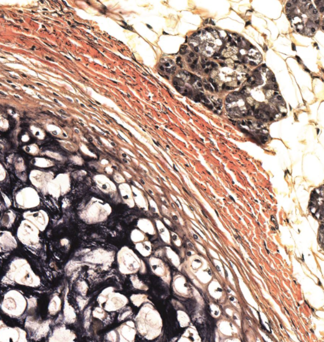 <p>the “inner”, more stringy looking tissue. </p>