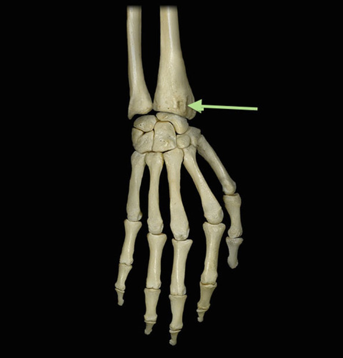 <p>What part of the radius is this?</p>