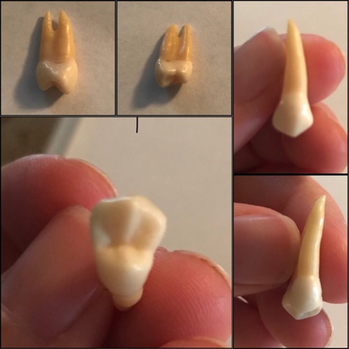 <p>What tooth is this ?</p>