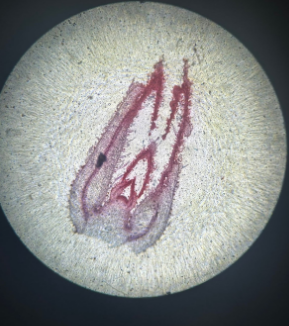 dicot stem