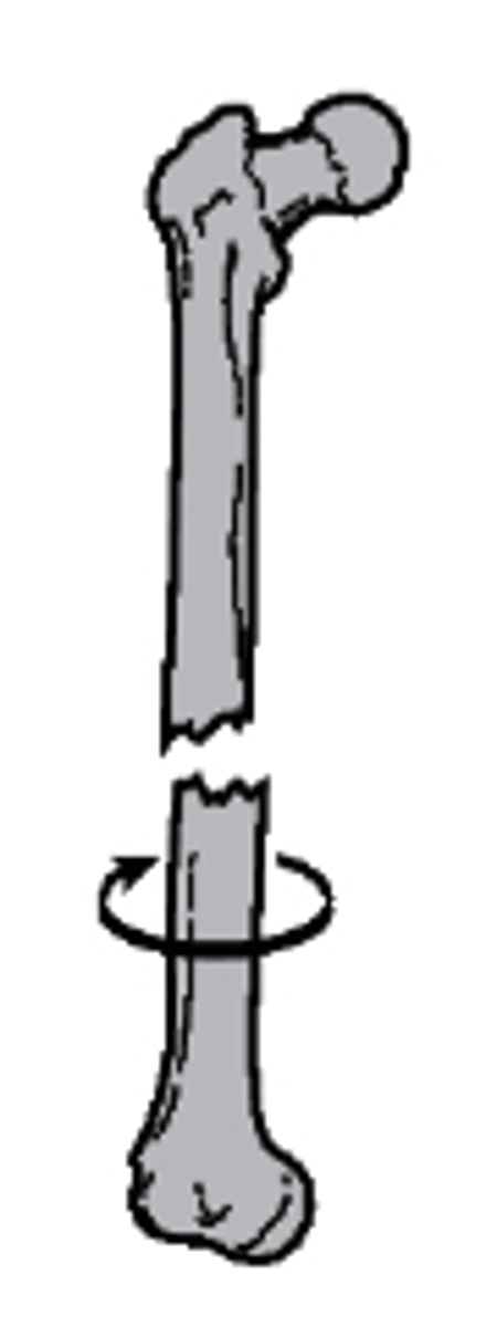 <p>what type of fracture is this</p><p>a. overriding with posterior and superior displacement</p><p>b. distracted</p><p>c. lateral displacement</p><p>d. distracted and rotated laterally</p>