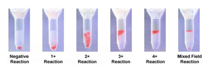 <p>- ID-MTS Gel card</p><p>-uses dextran acrylamide gel particles to trap agglutinated red cells</p>