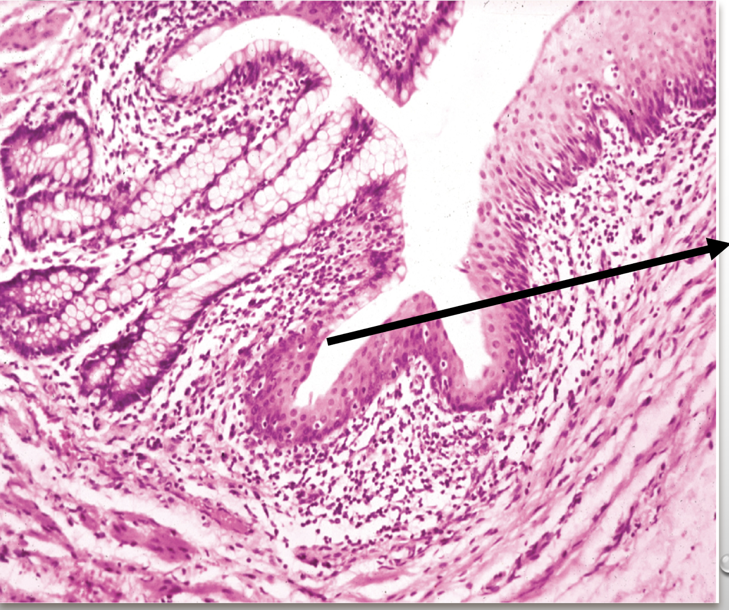 <p>identify the structure</p>