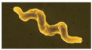 <p>slightly curled or spiral-shaped body</p>