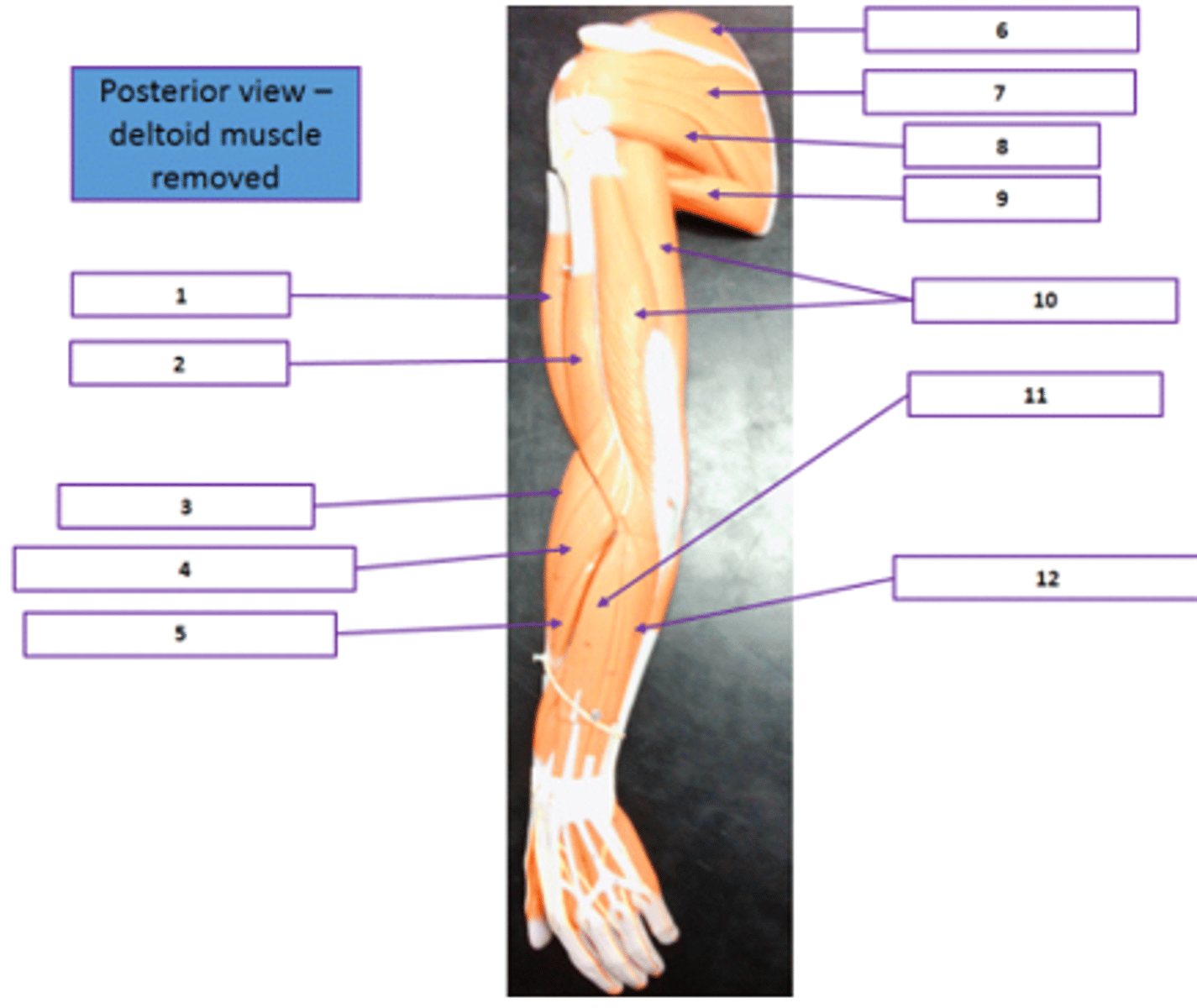 <p>Identify the muscle labeled 7.</p>