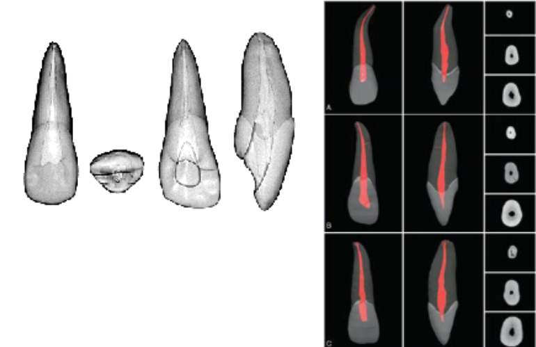 <p>ovoid (slightly flattened MD)</p>