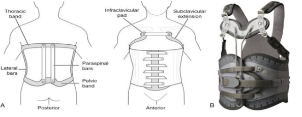 <p>Identify this Orthosis</p>