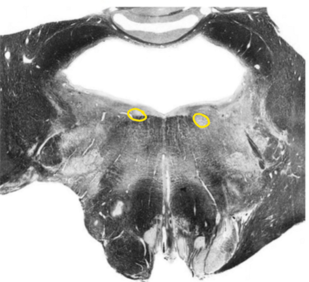 <p>ID the nucleus</p>