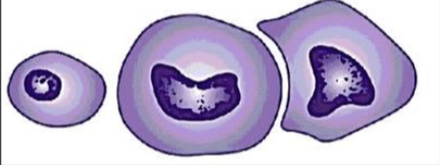 <p>What term is used for variable size and shape in a cell of the same type?</p>