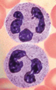<ul><li><p>A type of White blood cell (Leukocytes)</p></li></ul><p></p><p><u>Granulocytes</u></p><ul><li><p>Most numerous WBCs 50-70% of WBCs</p></li><li><p>Granules contain either <strong>hydrolytic enzymes</strong> or <strong>antimicrobial proteins “brew“</strong> called <strong>defensins</strong> (spears)</p></li><li><p><strong>Very phagocytic</strong></p><ul><li><p>a cell that is highly capable of <strong>phagocytosis</strong>, meaning it can efficiently engulf and destroy foreign particles, such as bacteria, fungi, and cellular debris. referred to as “bacteria slayers”</p></li></ul></li><li><p><strong>Defensis</strong> granules merge with <strong>phagosome(vesicle)</strong></p><ul><li><p>Form “spears“ that piece holes in membrane of ingested microbe</p></li></ul></li></ul><p>Characteristics:</p><ul><li><p>Multilobed nucleus</p></li><li><p>Lilac color cytoplasm, due to pale red and blue cytoplasmic granules</p></li></ul><p></p>