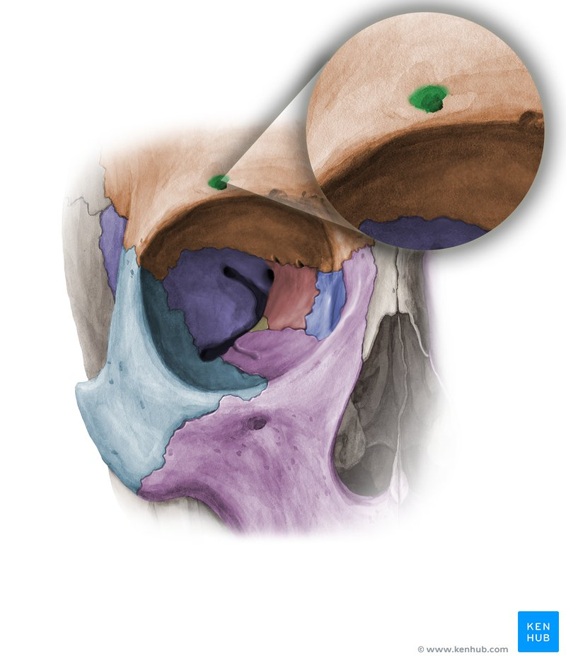 term image