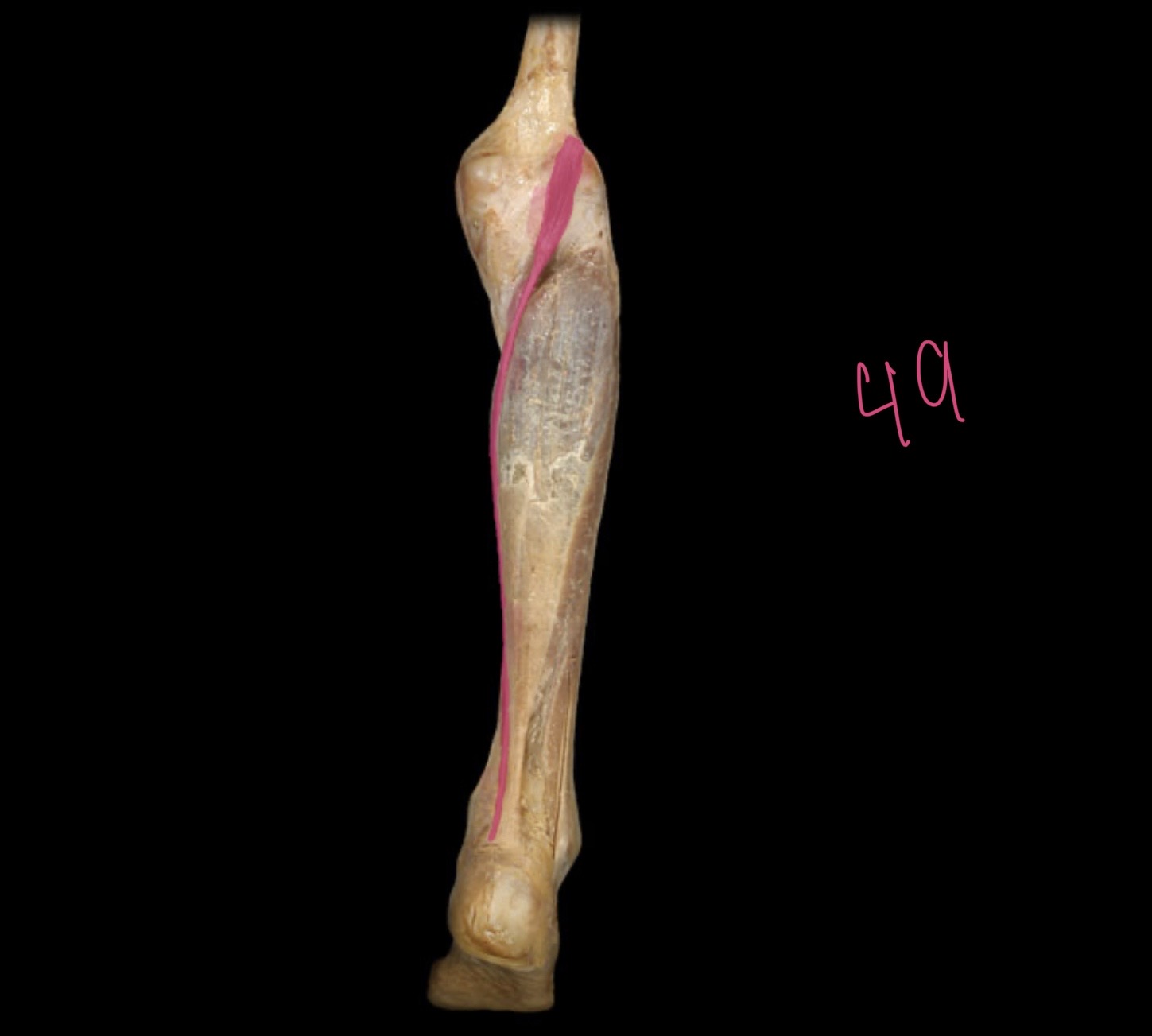 <p>Plantaris m</p>